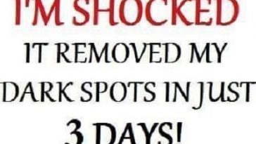 It Removed My Dark Spots and Made my Skin Clearer